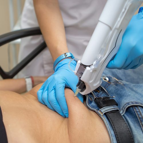 carboxytherapy-for-weight-loss-in-the-waist-on-the-2023-11-27-05-34-19-utc carboxytherapy-for-weight-loss-in-the-waist-on-the-2023-11-27-05-34-19-utc