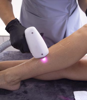 Young woman receiving photo epilation while visiting beauty center on salon, professional female beautician doing laser hair removal procedure on clients body. Cosmetology concept